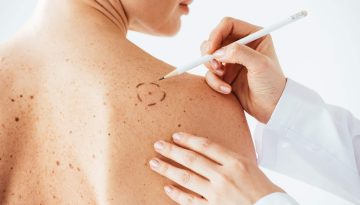 Nei pericolosi: come riconoscerli e come prevenire brutte sorprese