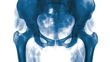 Pavimento pelvico maschile: come, quando e perché allenarlo